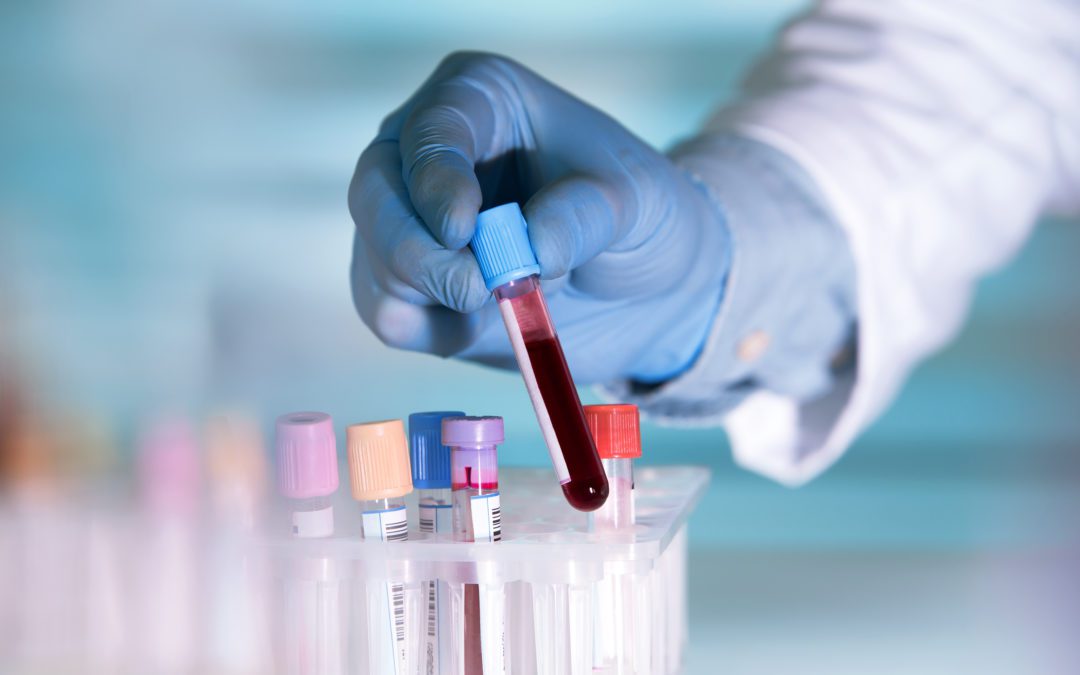 DUI – Can You Refuse a Blood Test?