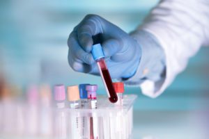 can you refuse a blood test DUI
